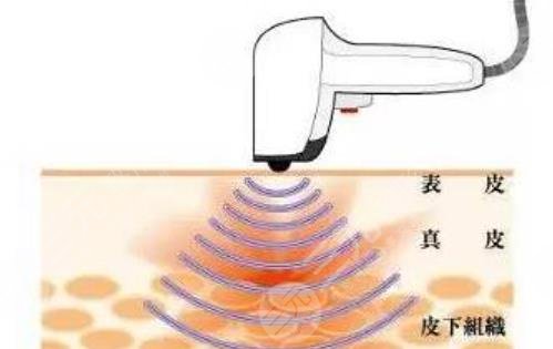 热拉提