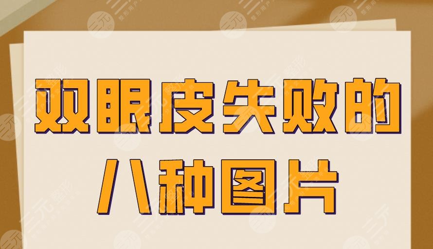 双眼皮失败的八种图片情况!这些都是失败的双眼皮,看看你有吗?