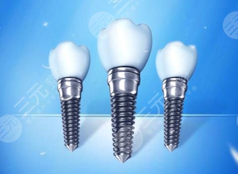 韩国奥齿泰种植牙质量怎么样