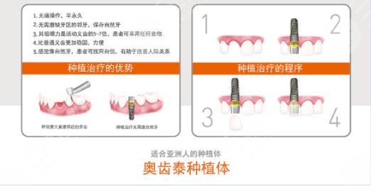 韩国奥齿泰种植牙多少钱