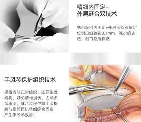 李继鹏医生技术优点