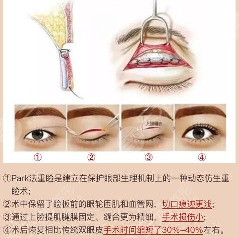 罗金刚医生技术优点
