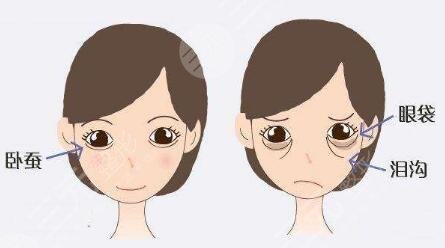 面部填充术后的注意事项