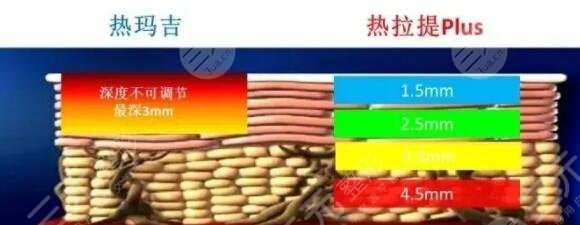 热拉提和热玛吉的区别