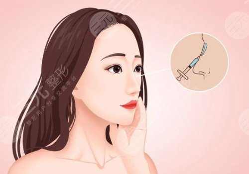 隆鼻之后吃什么