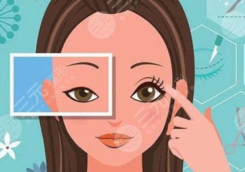 双眼皮修复术前准备工作