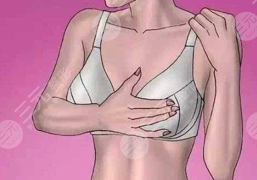 傲诺拉隆胸的果