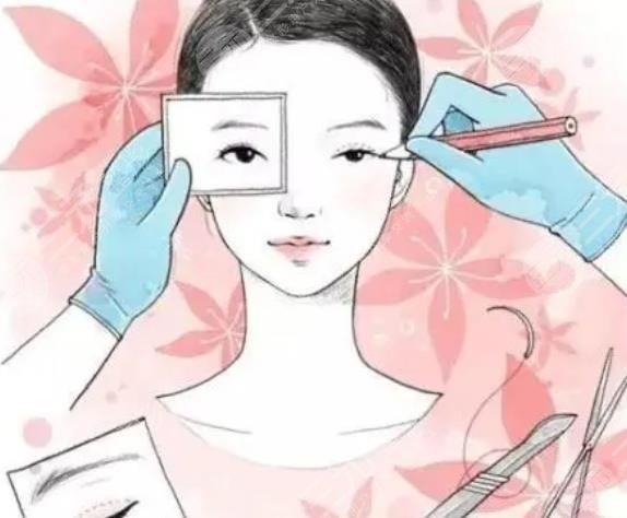 南方医院整形科双眼皮案例