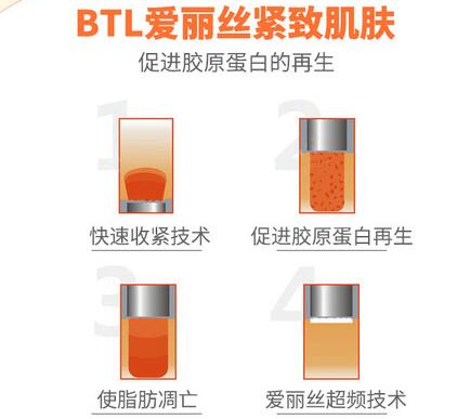 btl射频紧肤好吗