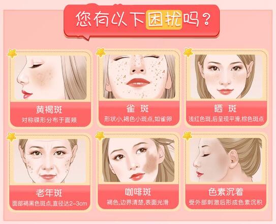 缓解牛奶咖啡斑的方法
