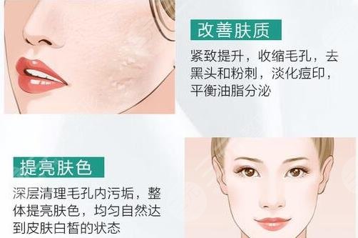 光子嫩肤