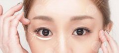 什么是超声法去眼袋，成好吗，多少钱？科普解答&2021价格指南！