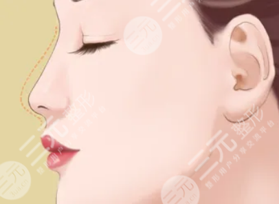 范元涛医生整形项目科普