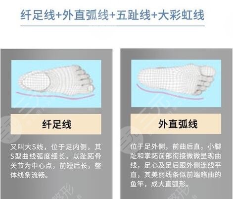 大脚骨外翻怎样缓解，多少钱？科普讲解&术后注意分享，美足攻略！