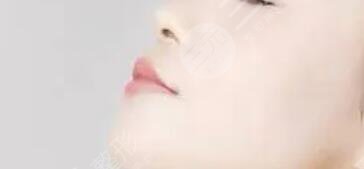 v美减龄
