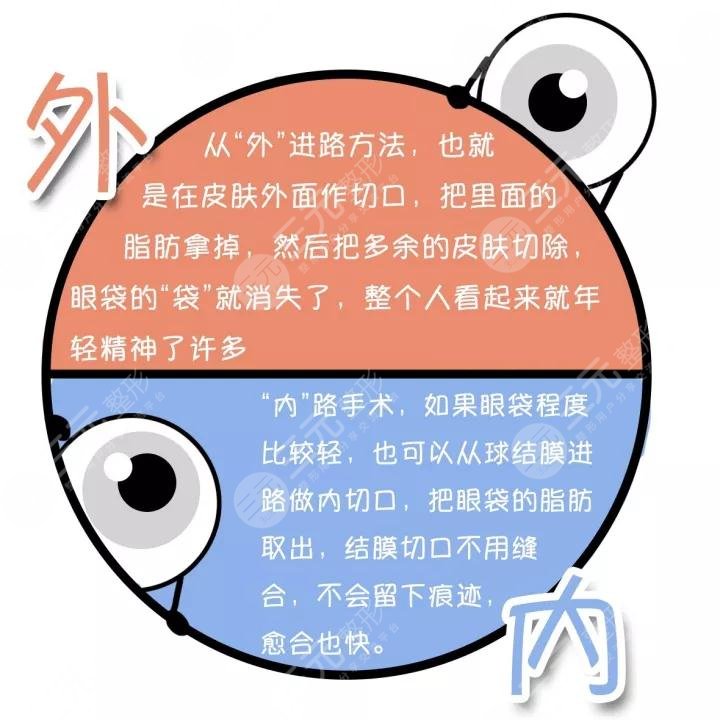 去眼袋良好技术