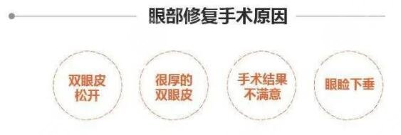上海朱迪双眼皮修复怎么样