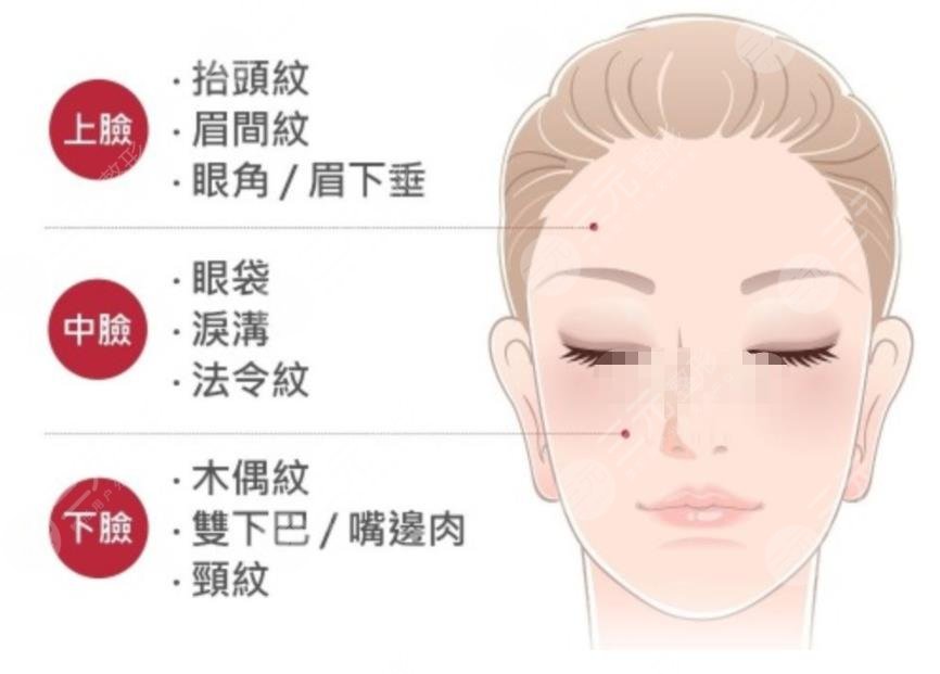 拉皮除皱的优势是什么?