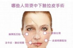 收藏|做完小切口拉皮多久可以消肿?原理_费用_果_优点超全盘点! 收藏|做完小切口拉皮多久可以消肿?原理_费用_果_优点超全盘点!