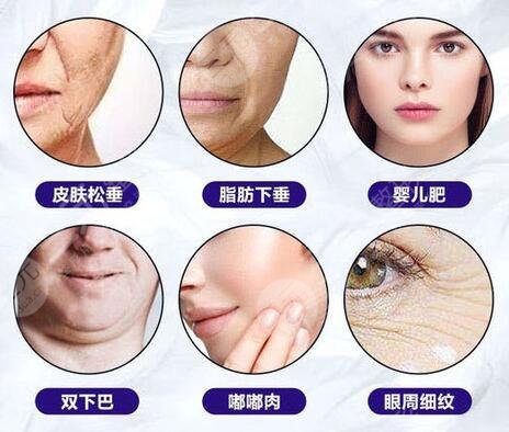 v美减龄适合人群