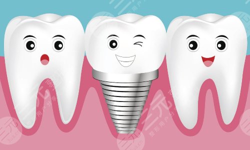 全口种植牙的利
