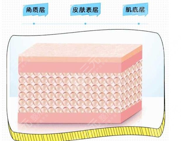 嗨体除皱术后注意事项有什么?