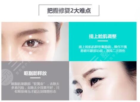 双眼皮修复手术