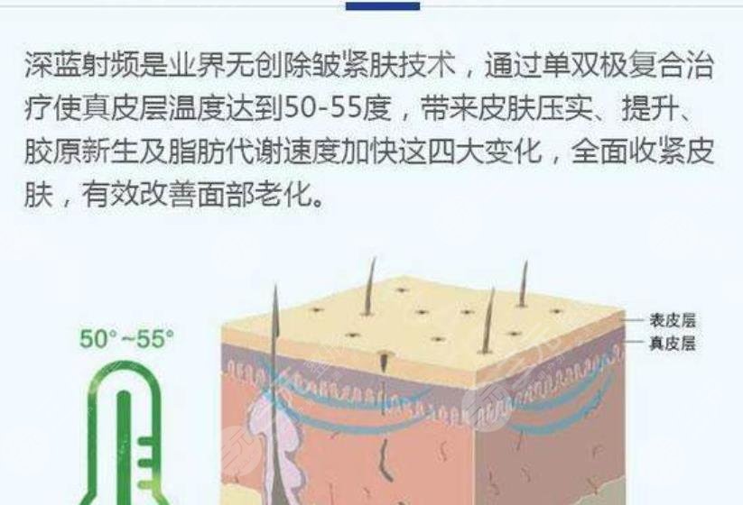 深蓝射频