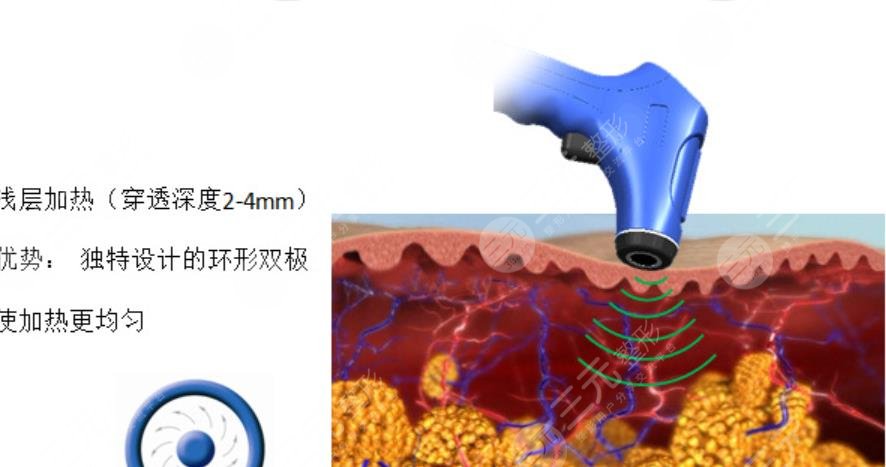 深蓝射频