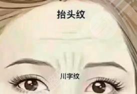 川字纹