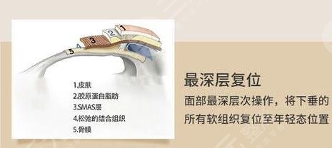 v美减龄