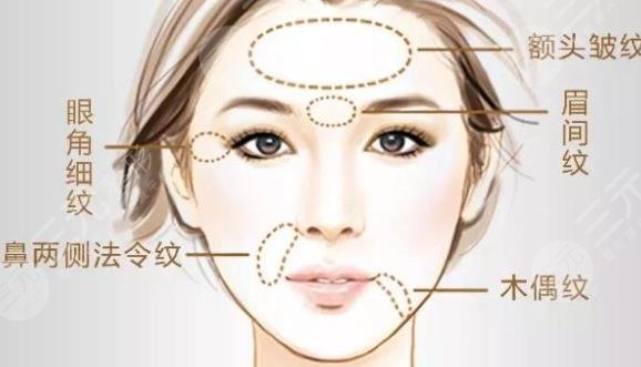 注射注射除皱的副作用