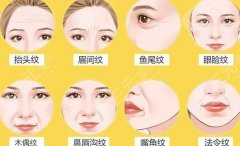 热提拉和热玛吉哪个更好？有什么区别？快来pick适合你的抗衰项目