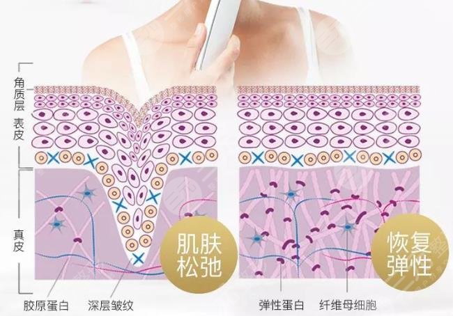 热提拉的功与副作用