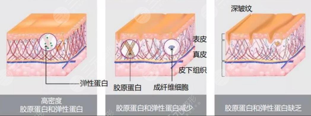 5gmax极速提拉怎么样