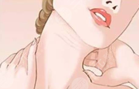 去颈纹