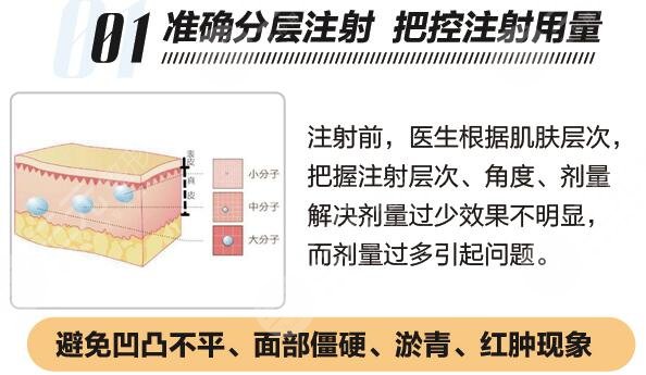 玻尿酸填充川字纹