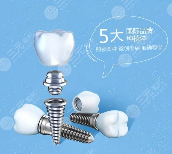 种植牙技术的价格