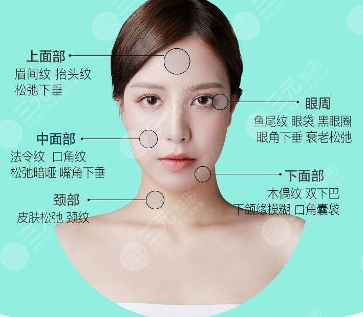 微创拉皮手术费用高吗