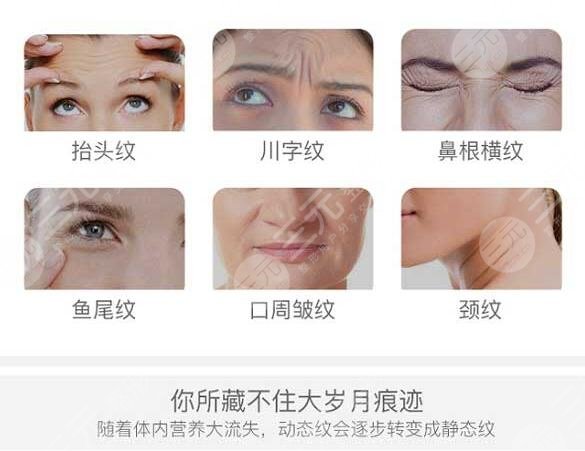 除皱美容手术方式包括什么