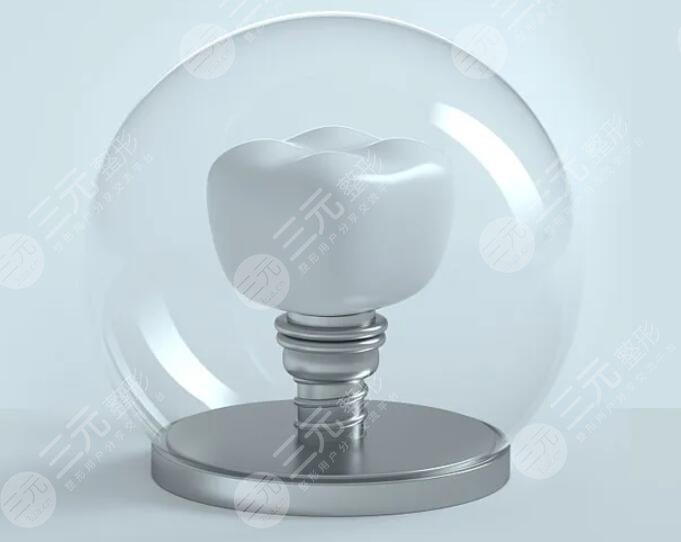 做种植牙的注意事项