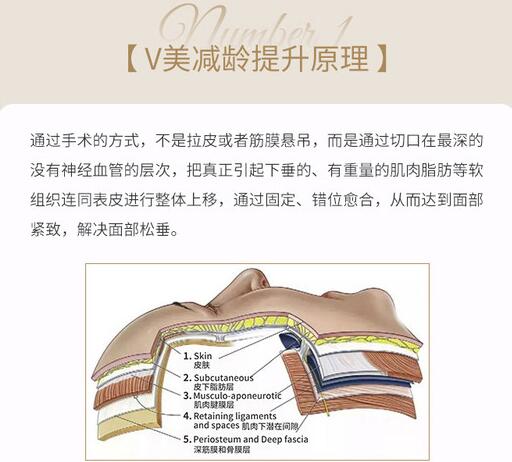 v美减龄面部抗衰术