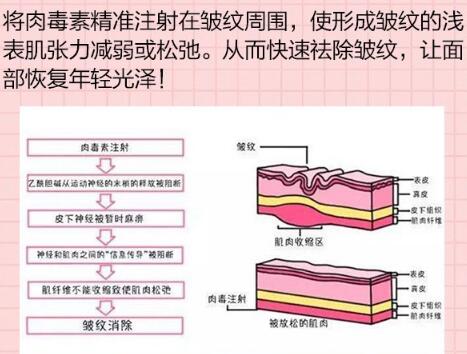 川字纹用什么填充果好?
