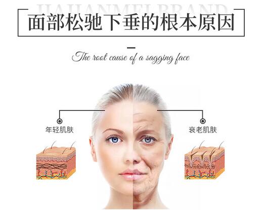 v美减龄是什么手术,面部抗衰是怎样的做法?超全科普为您解读抗衰! v美减龄是什么手术,面部抗衰是怎样的做法?超全科普为您解读抗衰!