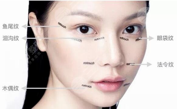 迷你小拉皮除皱手术降低风险吗