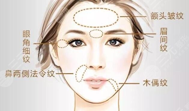 拉皮除皱时候有什么副作用呢