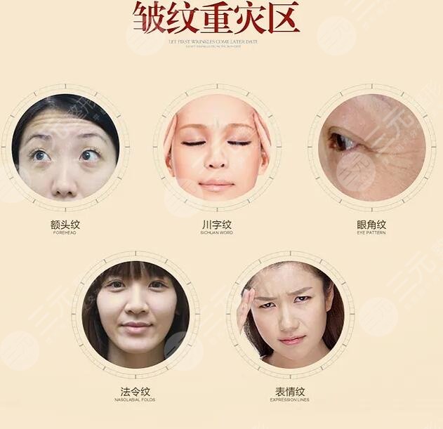 拉皮除皱手术之后会有什么样的果