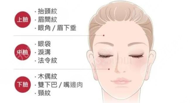 大拉皮手术恢复期多少天