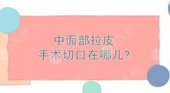 中面部拉皮手术切口在哪儿?避免后遗症方法盘点!轻松get紧致肌肤 中面部拉皮手术切口在哪儿?避免后遗症方法盘点!轻松get紧致肌肤