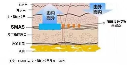 射频除皱是什么原理